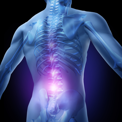 image of a figure experiencing back pain